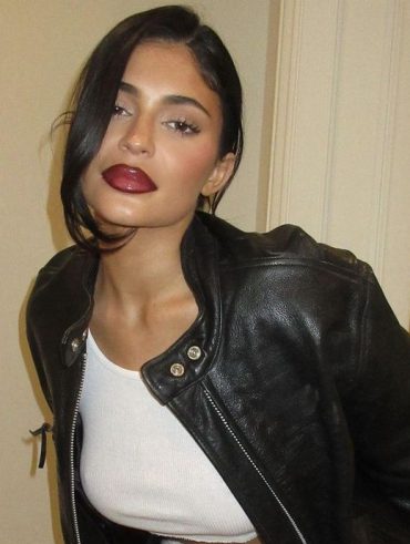 Cherry Lips: saiba como fazer a nova tendência