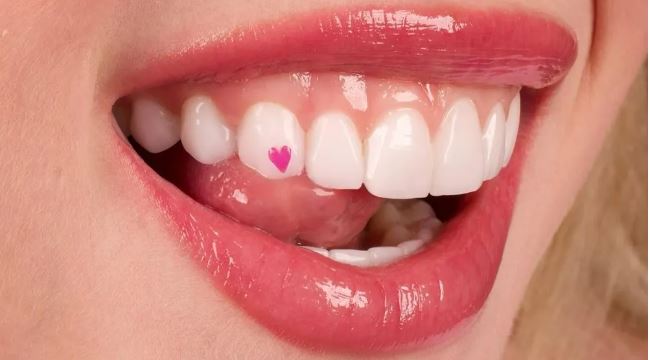 Duda Reis compartilha foto de piercing no dente com pedra verdadeira