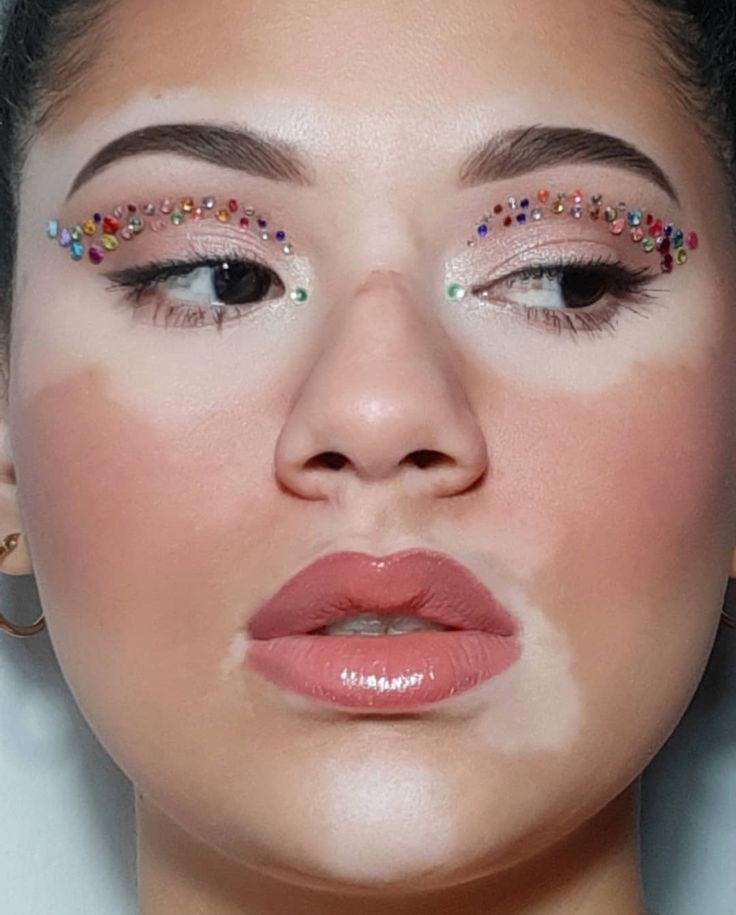 Mulher com vitiligo, lábio com gloss e delineado com pedras coloridas