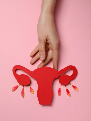 Cólica menstrual: veja como aliviar o sintôma