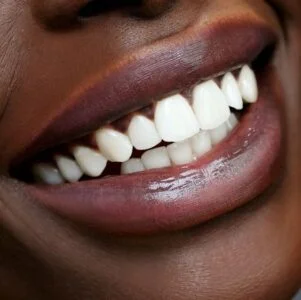 Boca com dentes brancos e pele negra.