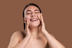 Cuidados com a pele para tratar acne