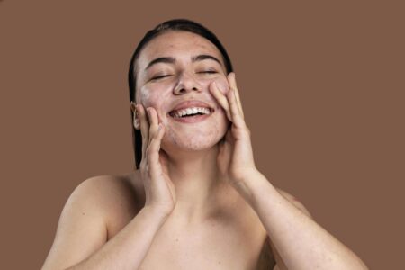 Cuidados com a pele para tratar acne