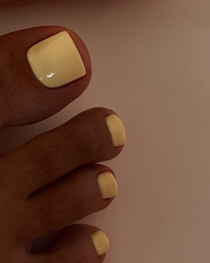 Pés de pele 'preta', com unha amarelo-manteiga